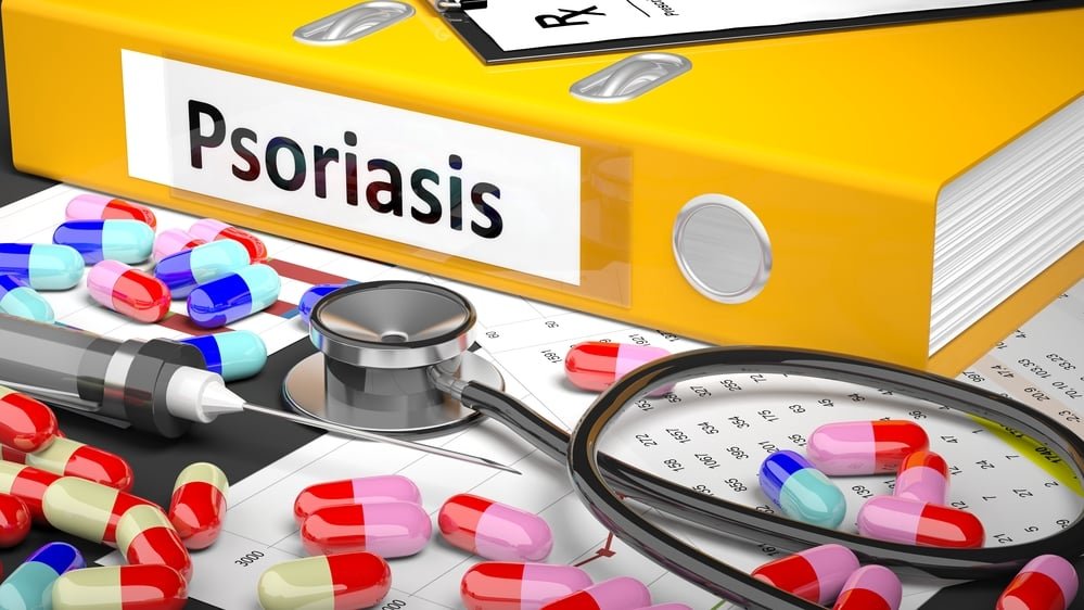 traitement du psoriasis